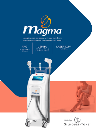 MAGMA_s